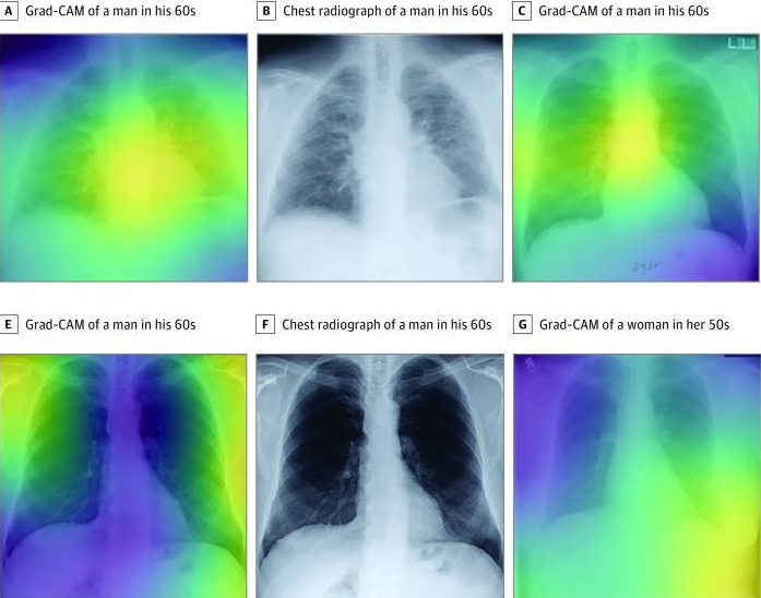 Artificial Intelligence in Cardiothoracic Imaging